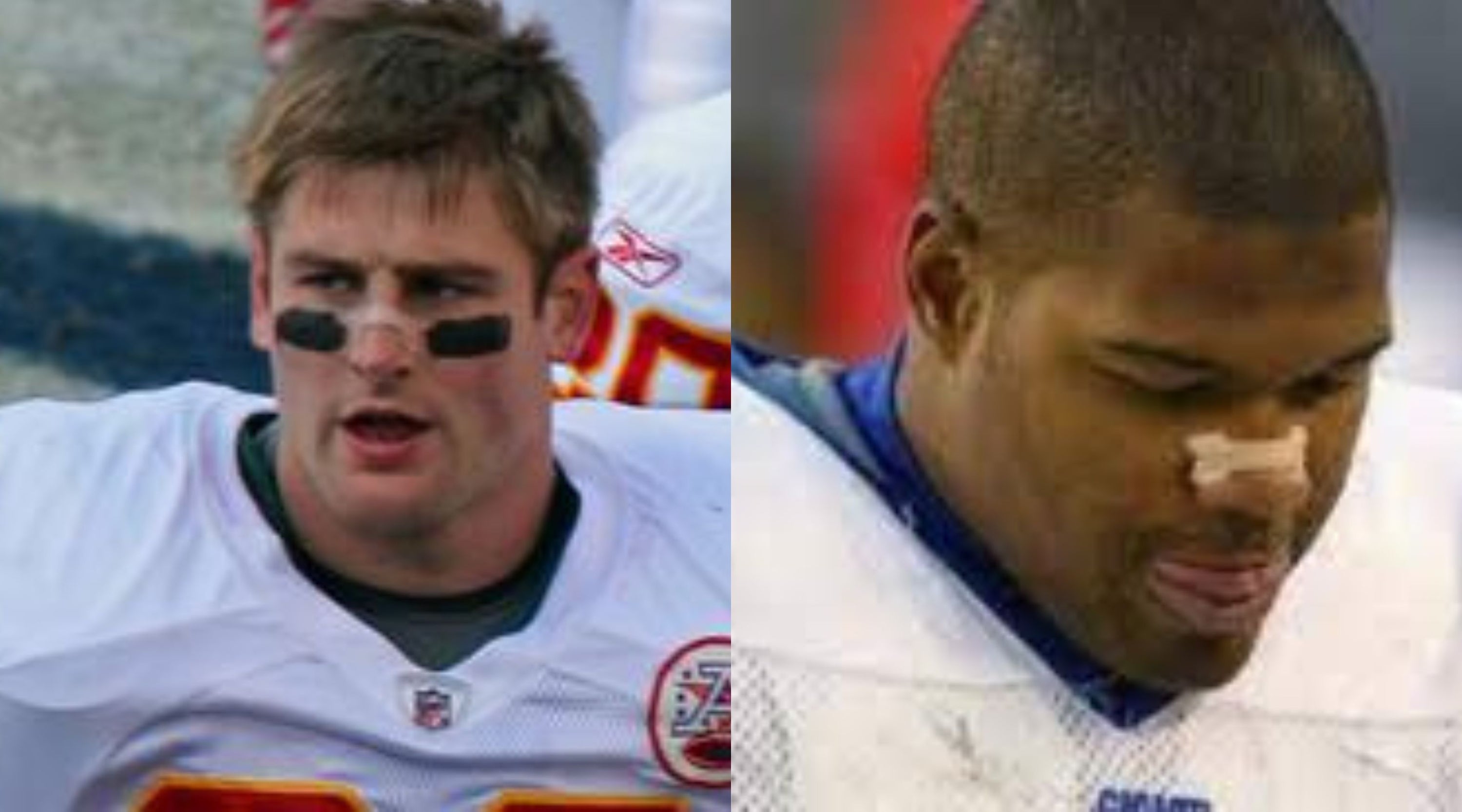 Professional athlete using nasal strip for improved breathing